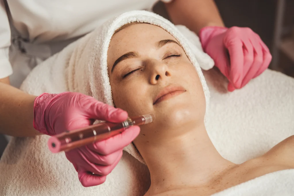 Microneedling
